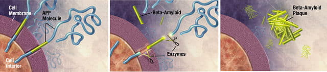 Beta Amyloid formulowanie plytek starczych