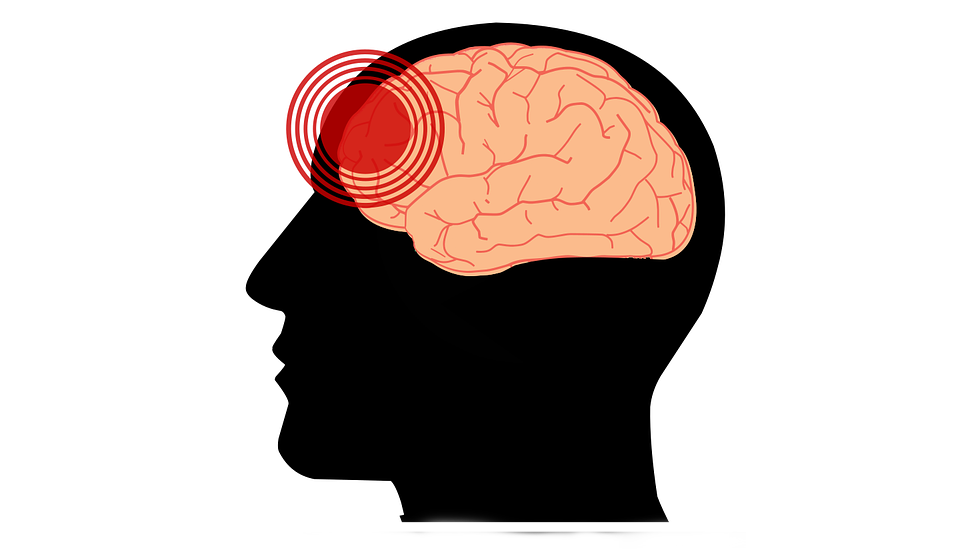 Migrena i mudra na ból głowy – 3 x 6 minut dziennie 2 migrena